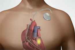 best angioplasty doctor in Kolkata