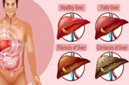 best angioplasty doctor in Kolkata