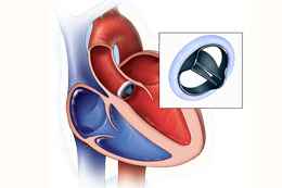 best angioplasty doctor in Kolkata